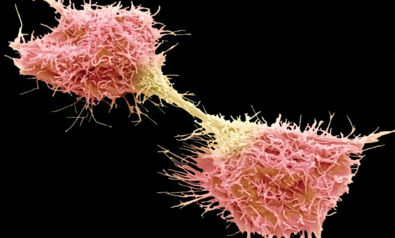 10 faits sur les cellules cancéreuses