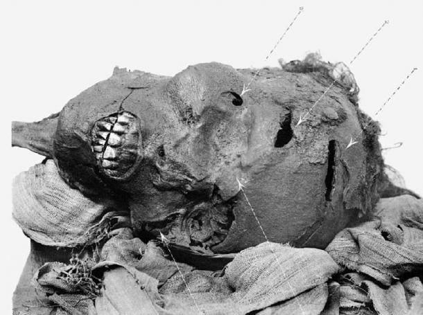 La momie du pharaon Séqénenre Tao montrant des blessures à la tête. (G. Elliot Smith / Domaine public)