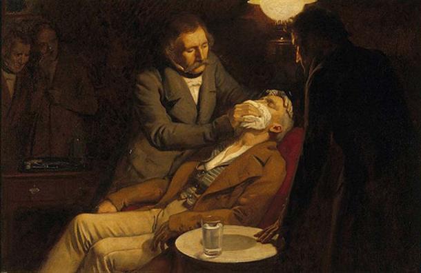 Illustre la première utilisation de l'éther comme anesthésique en 1846 par le chirurgien dentaire W.T.G. Morton. (catalogue.wellcome.ac.uk / Domaine public)
