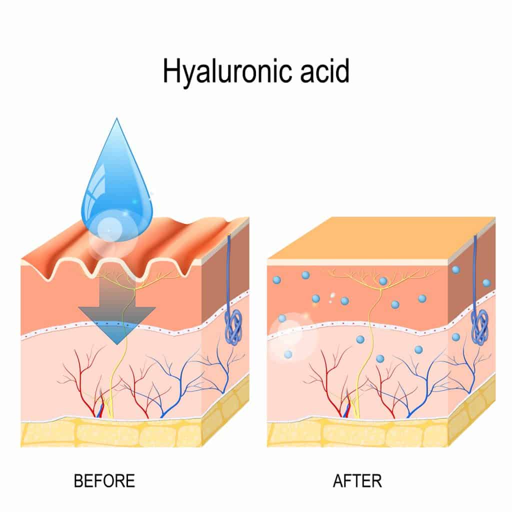 Acide hyaluronique