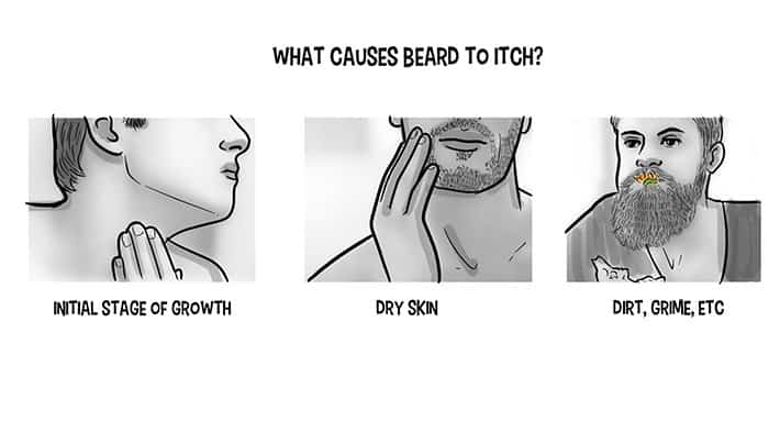 L'huile de barbe aide à se débarrasser de la redoutable démangeaison de la barbe