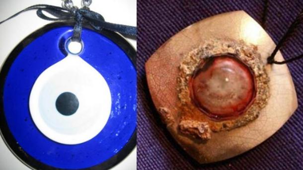 A gauche, le Nazar bleu, et à droite, le pendentif oeil de rubis d'une ancienne Mésopotamie