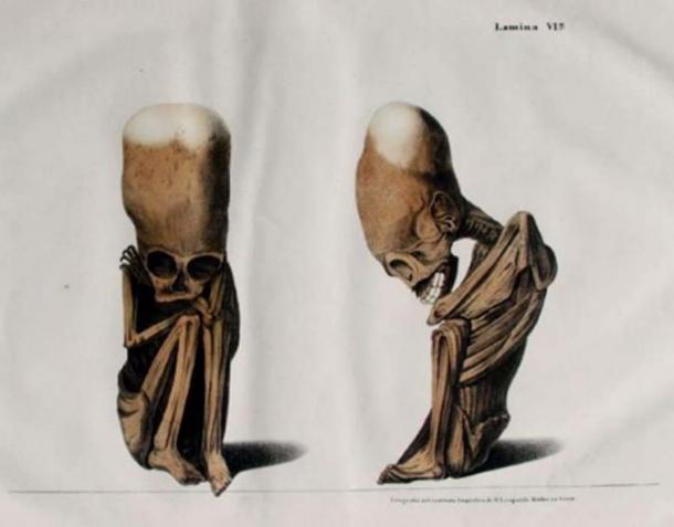 Fœtus de Rivero et Tschudi avec tête naturellement allongée de leur 1851 