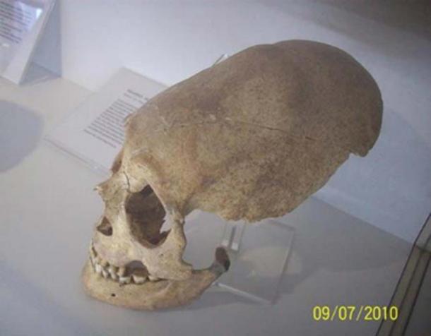 Un crâne allongé trouvé en Allemagne. (soul-guidance.com)