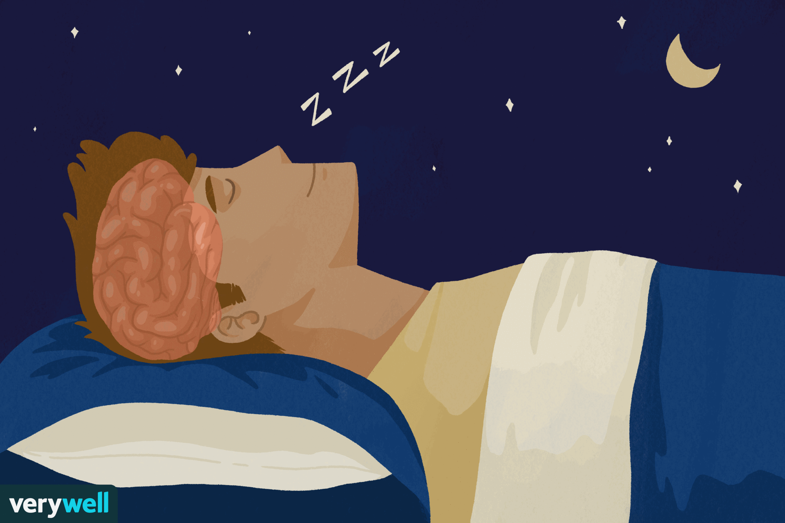 Comment le sommeil affecte la santé mentale