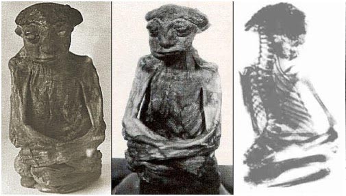 Photos et radiographie de la momie de San Pedro