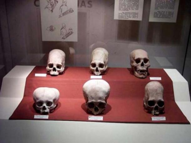 Un cas de crânes de la culture andine de Paracas, comme on peut le voir au Museo Nacional de Arqueología, Antropología e Historia del Perú à Lima. (CC PAR SA 3.0 )