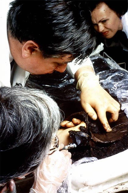 Des chercheurs examinent les restes de Lindow Man au British Museum. (Administrateurs du British Museum)