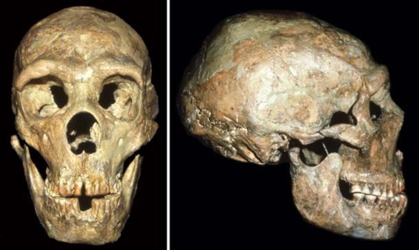 Le crâne du Neandertal connu sous le nom de Shanidar 1 présente des signes d'un coup à la tête reçu à un jeune âge. (Image : avec l'aimable autorisation d'Erik Trinkaus)