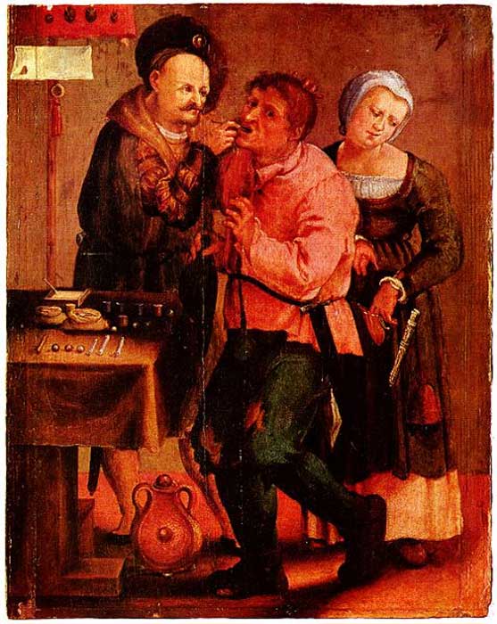 Dentiste médiéval en train d'enlever une dent, probablement en 1616-1677. 