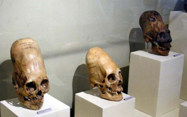 Exemple des crânes allongés de Paracas. (Domaine public)