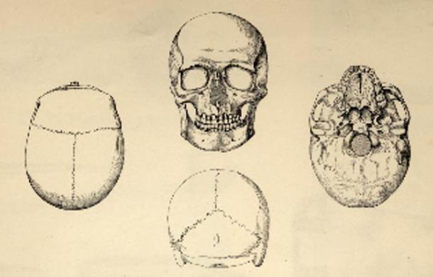 Dessins du crâne de l'homme de Gristhorpe, J. et W.C. Williamson